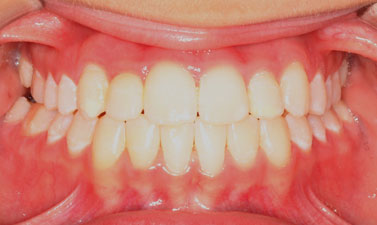Before & Afters