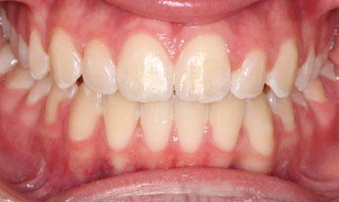 Before & Afters