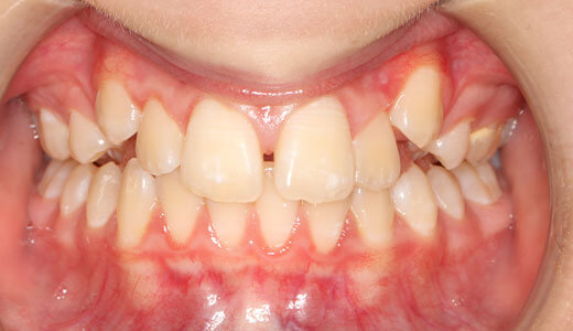 Before