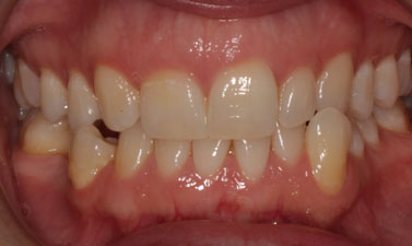 Before & Afters