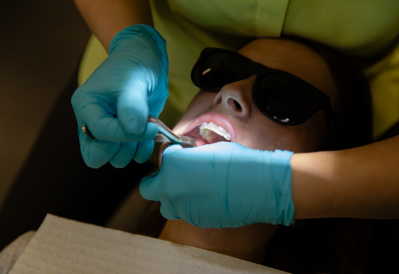 The process of getting your braces removed