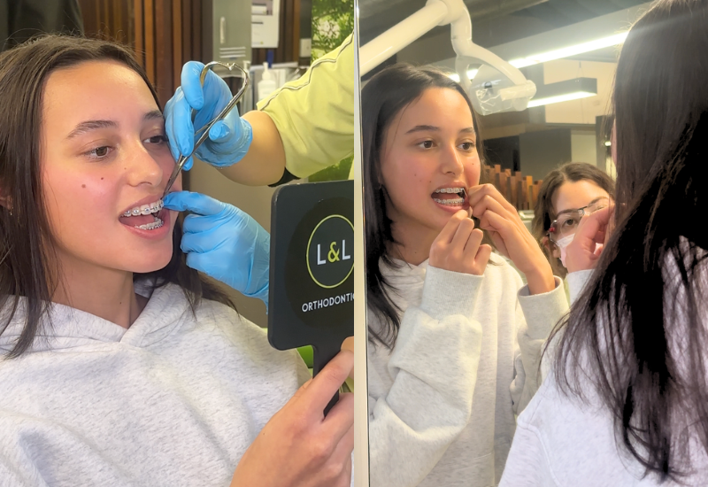 The L&L Orthodontics clinical team showing a patient how to wear their elastics as recommended by their specialist orthodontist